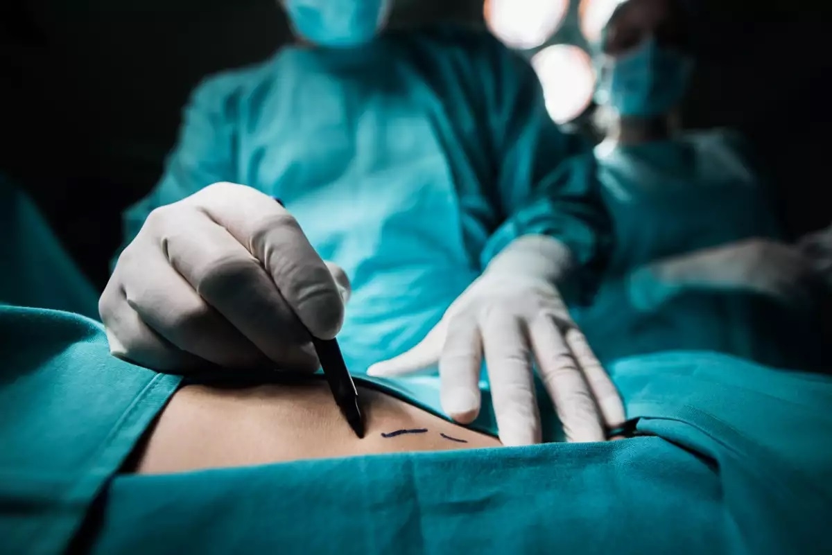Mujer muere durante cirugía de levantamiento de glúteos