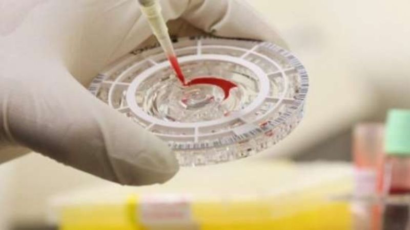 Síntomas del virus Chapare; alertan por nuevo brote en Bolivia