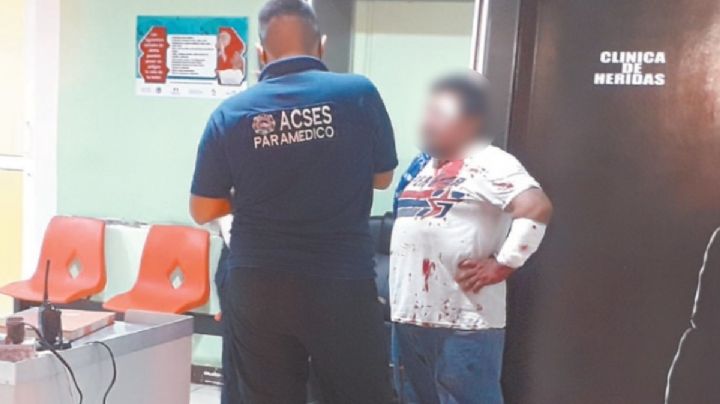 Por equivocación, machetean a un hombre en Ciudad del Carmen
