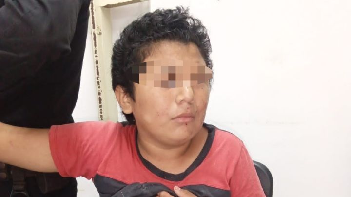 Niño pierde un dedo al estallarle una “bombita” en Tzucacab, Yucatán