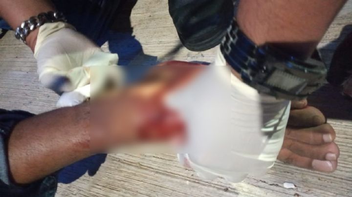Hombre termina baleado tras una riña en la colonia Payo Obispo de Chetumal