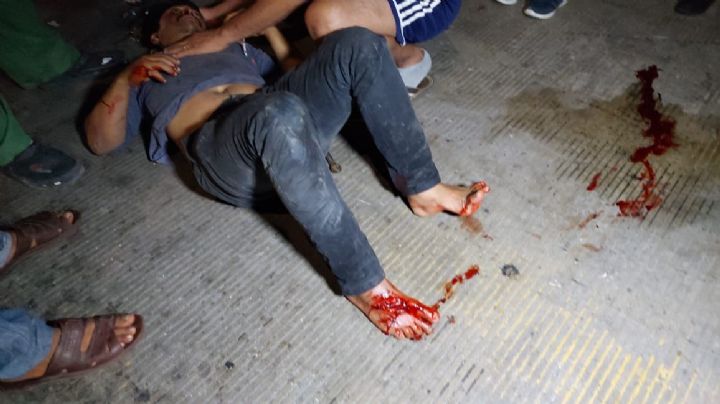 Motociclista choca contra un taxi y termina con el pie abierto en Ciudad del Carmen