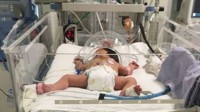 Suman 63 recién nacidos contagiados de COVID-19 en Quintana Roo