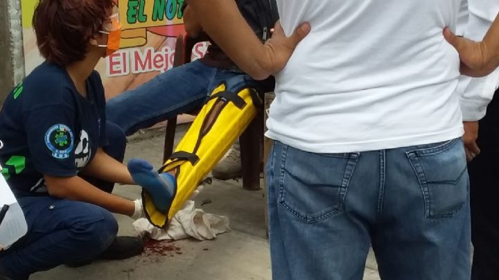 Motociclista se fractura una pierna tras chocar con un automóvil en Chetumal