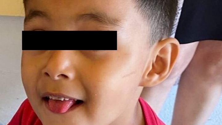 Niño de tres años muere tras visita al dentista en EU