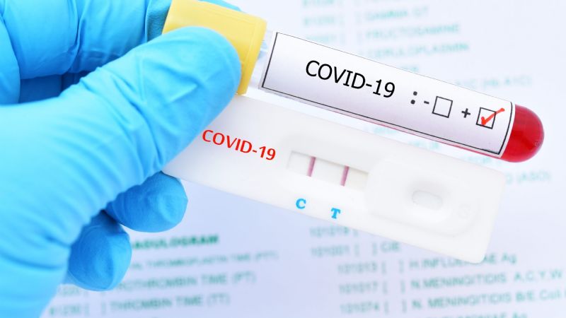 Crean Innovadora prueba PCR para detectar COVID-19 en niños