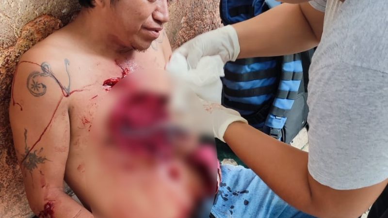Ebrio apuñala a su compañero de parranda durante pelea campal en Chetumal