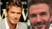 El antes y después de los rellenos en David Beckham
