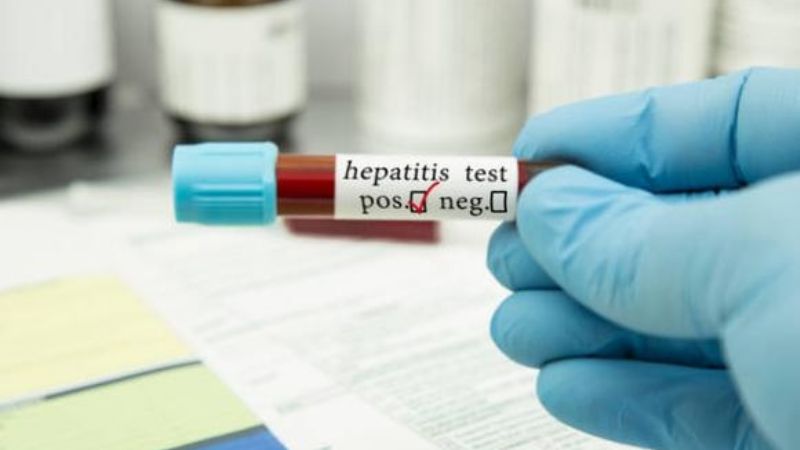 Sospechoso de hepatitis infantil es detectado en Tamaulipas