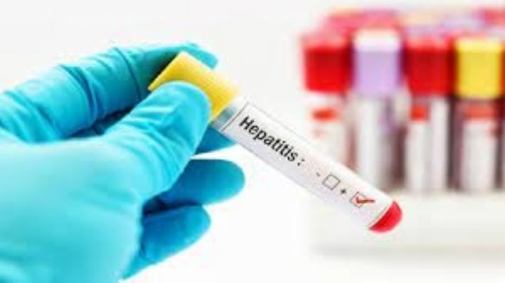 Detectan primer caso de hepatitis infantil aguda en Argentina