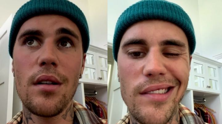 Justin Bieber sufre parálisis facial; reagendará conciertos: VIDEO