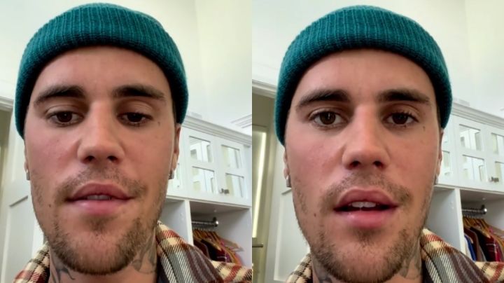 Justin Bieber: ¿Qué es el Síndrome de Ramsay Hunt, causante de su parálisis facial?