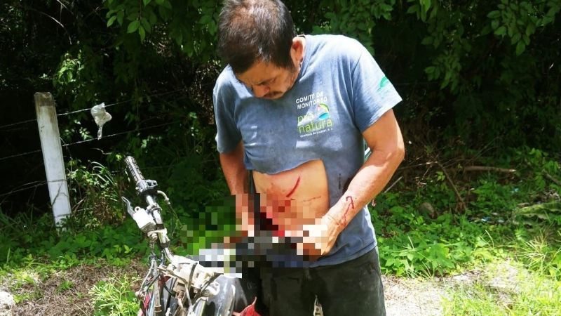 Motociclista termina con exposición de vísceras tras derrapar sobre la carretera Campeche-Mérida