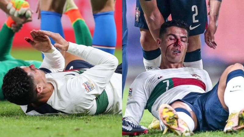 Así fue el tremendo golpe que recibió Cristiano Ronaldo jugando con Portugal: VIDEO