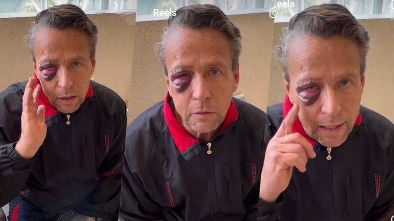 Alfredo Adame asegura que sus agresores le pegaron con una piedra en el rostro: VIDEO