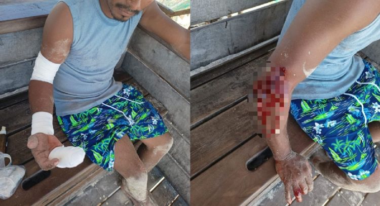 Pitbull ataca a un bañista en Playa del Carmen