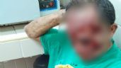Yucatán: Hombre resulta herido tras explotarle una llanta en la cara en Suma Hidalgo