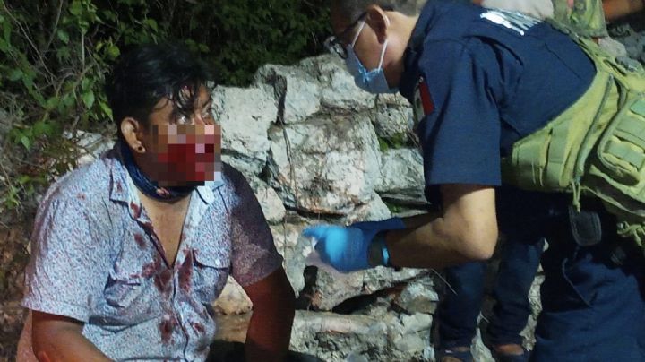 Joven resulta herido tras derrapar en su motocicleta en la vía Baca-Tixkuncheil